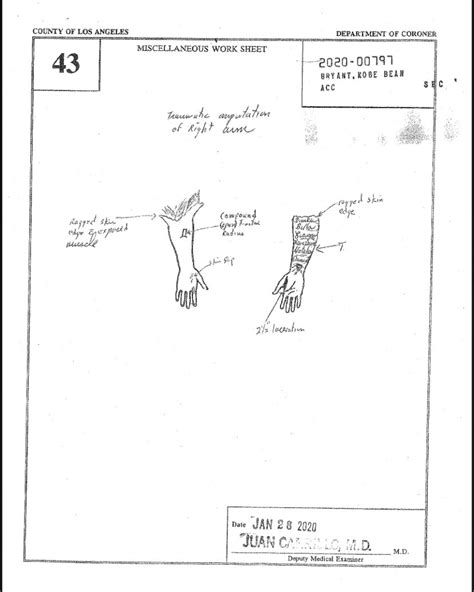 gigi bryants autopsy report|Kobe Bryant Autopsy Report